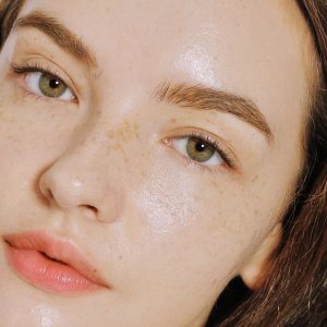 Mới bị nám phải làm sao, nên ăn gì, có chữa được không?